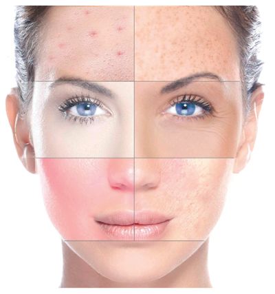 Afectiuni videcate de mezoterapie