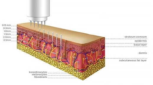 Procesul de vindecare