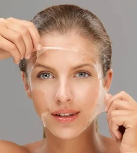 Peeling Chimic